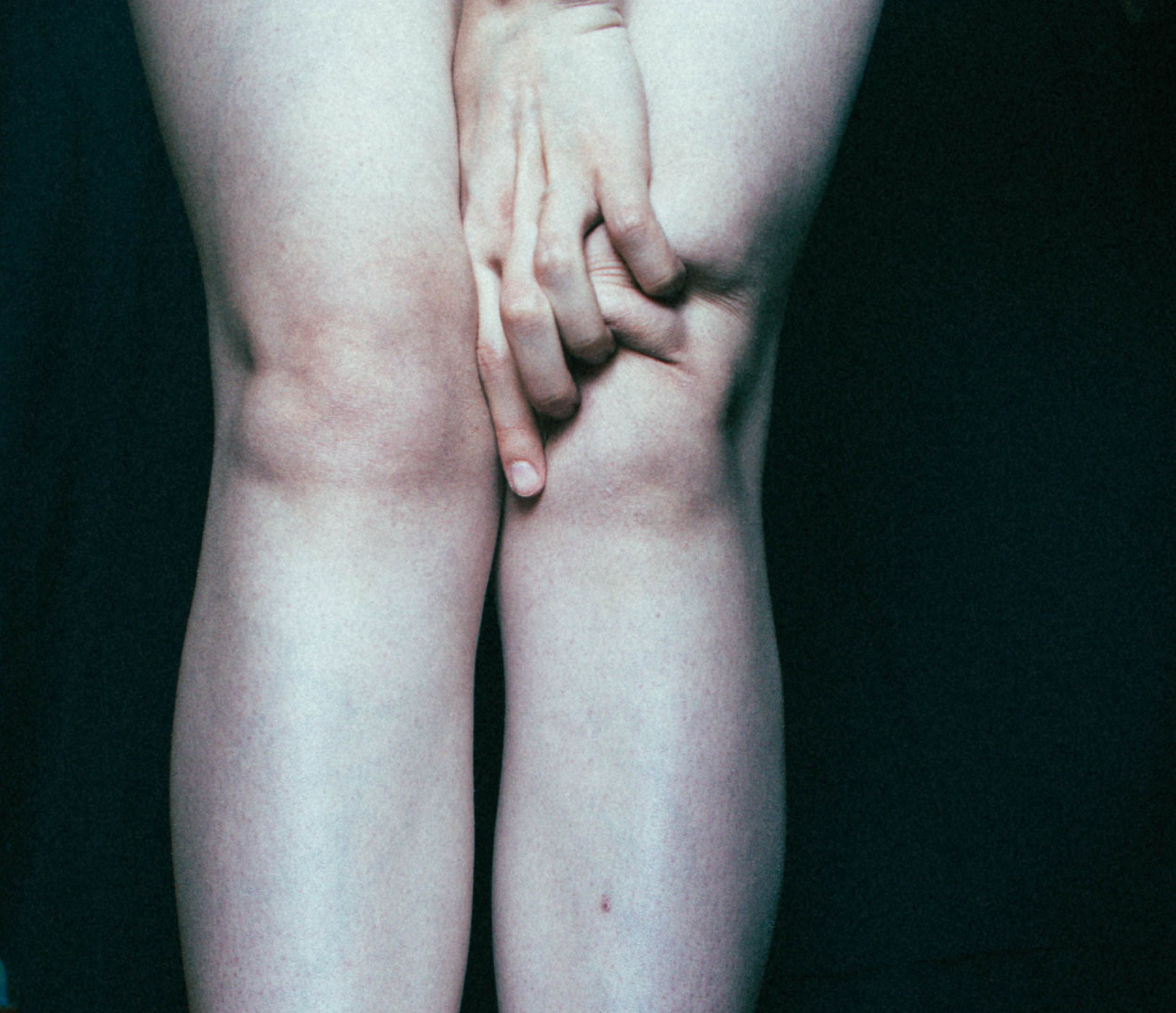 Artistic close-up of human hands and knees with a dark backdrop, emphasizing texture and posture.