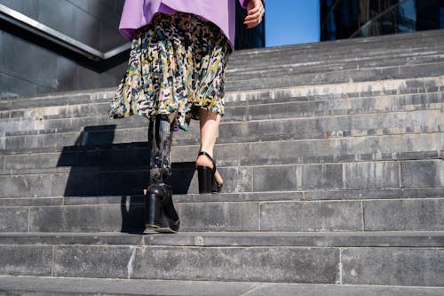 A Person Wearing Prosthetic Leg Walking Up the Stairs