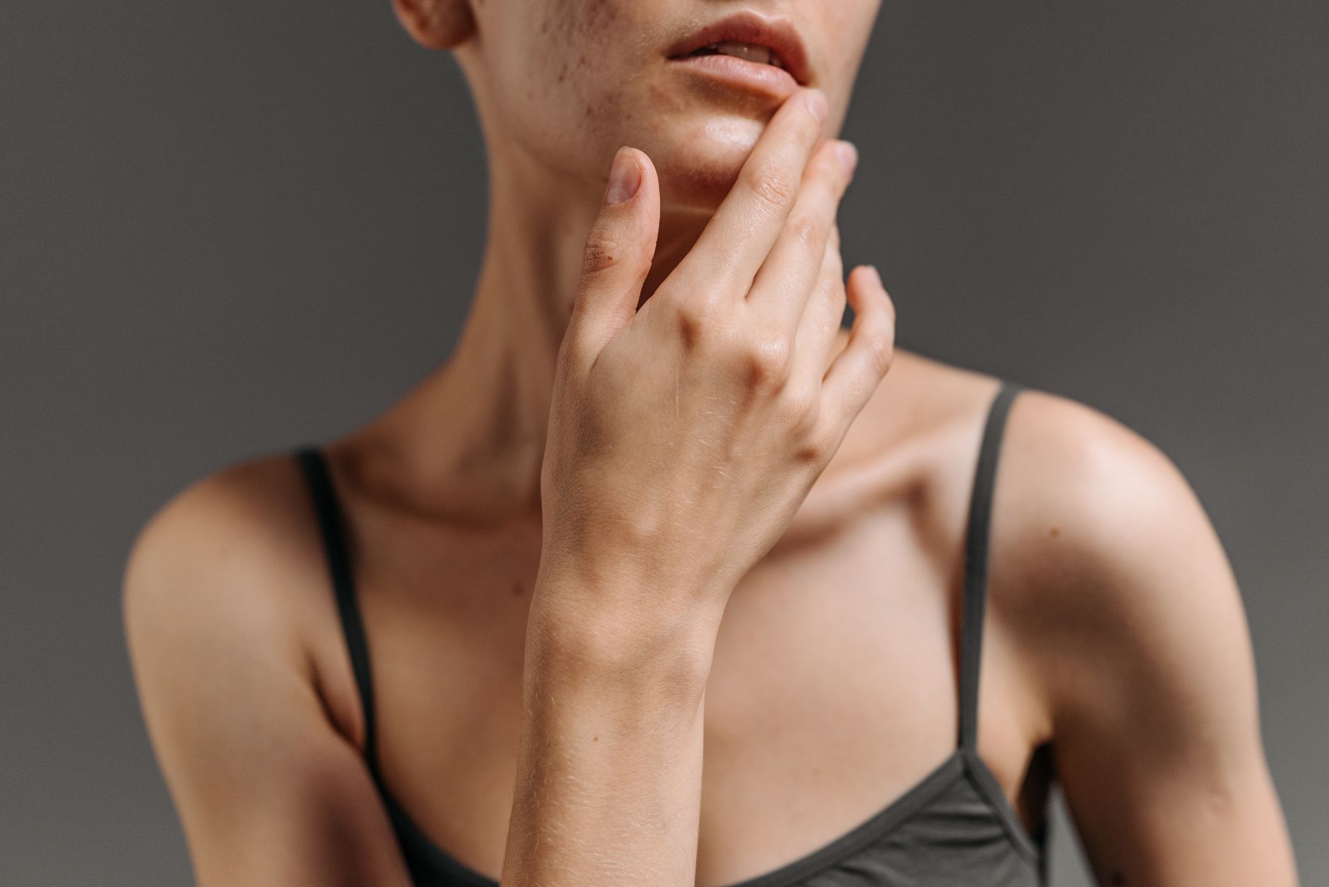 The Gut-Skin Axis: How Your Microbiome Shapes the Health of Your Skin