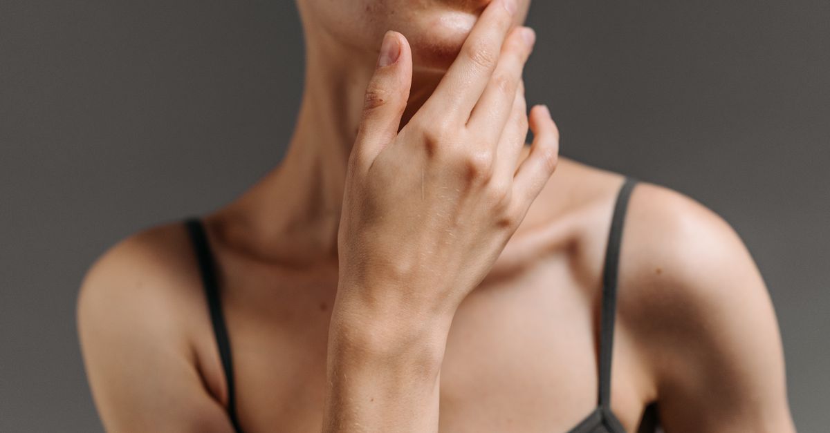 How Can Early Treatment Prevent Acne Scarring