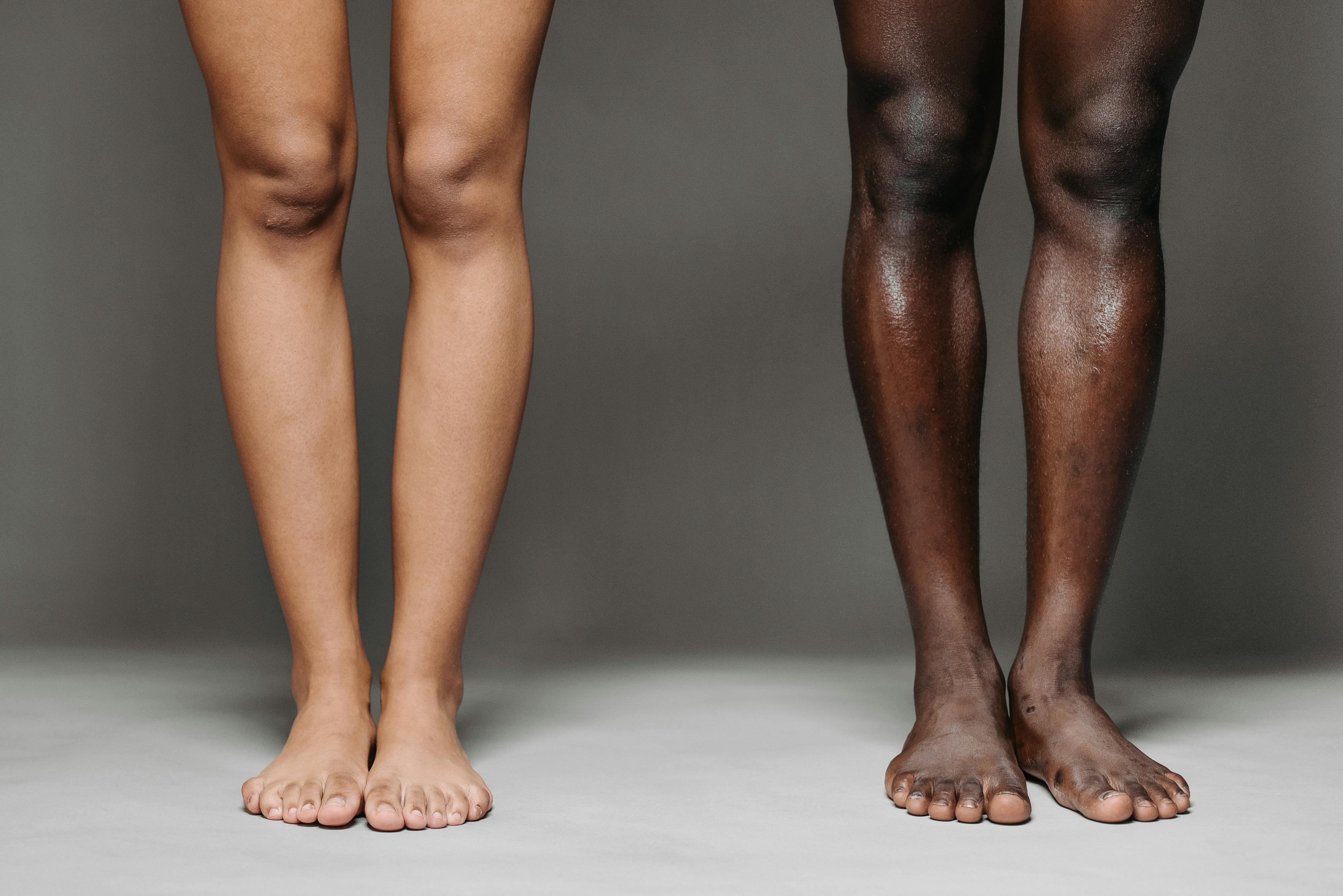 Image of two pairs of diverse bare legs standing against a gray background, showcasing skin tone variety.