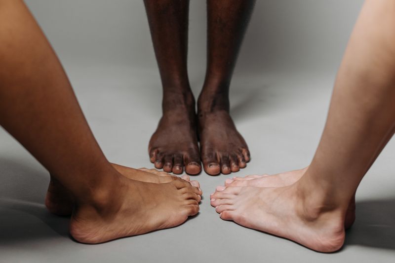 Bare feet, including richly pigmented skin, on a neutral floor. Gout most often strikes the big-toe joint and affects Black men at higher rates.