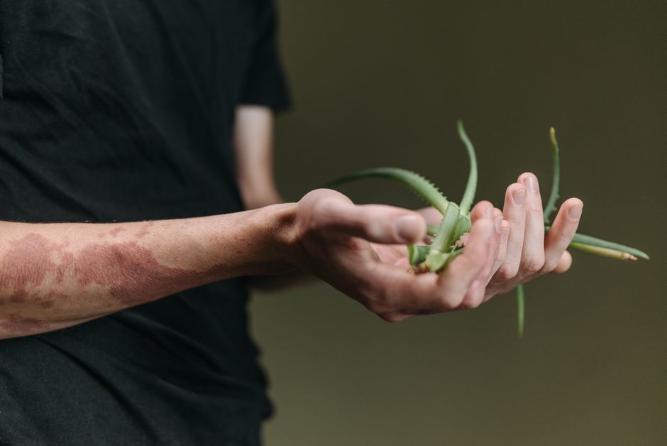 aloe vera for dark spots