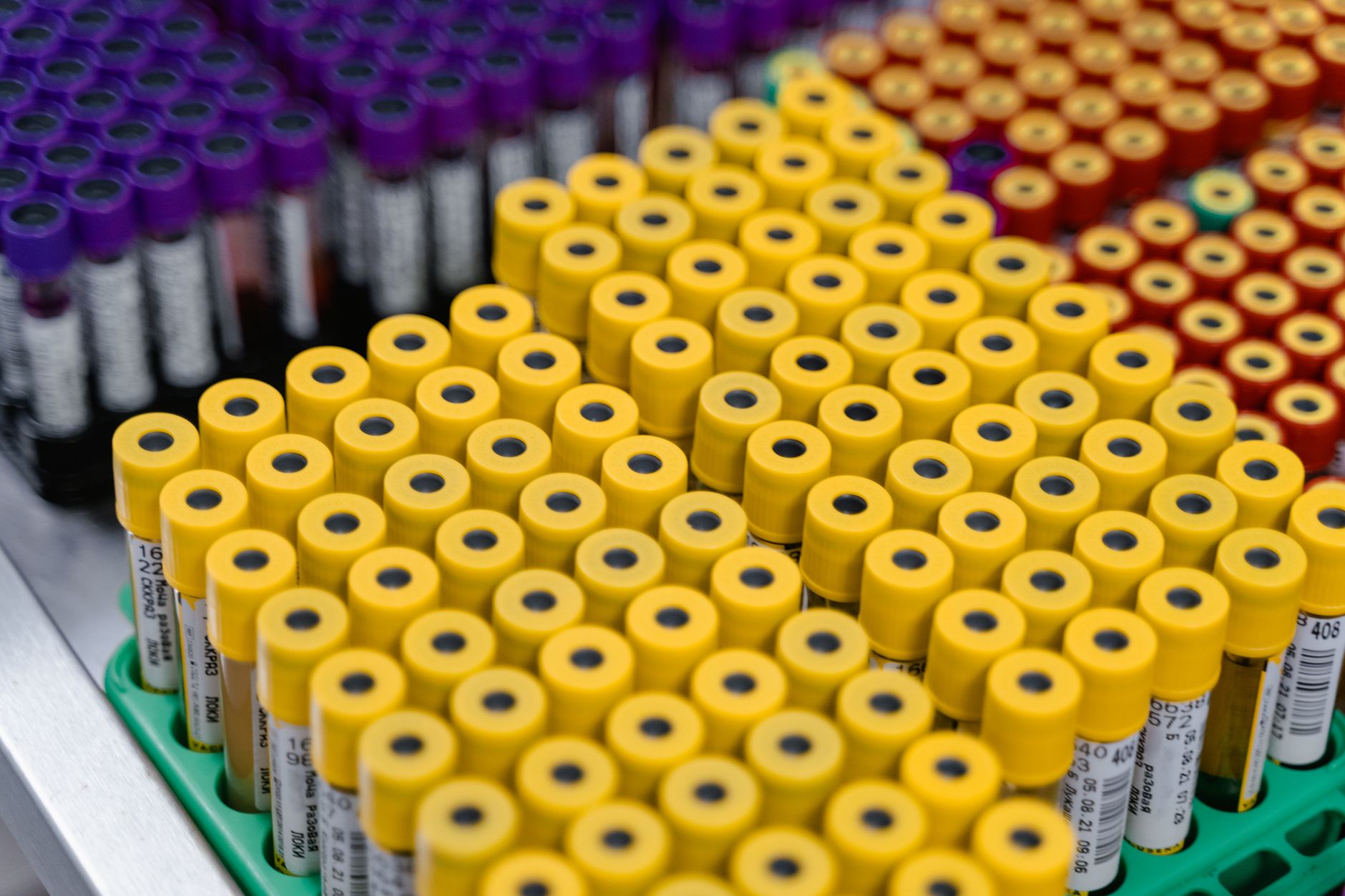 Close-up image of multiple test tubes in a laboratory setting displaying different colored caps.
