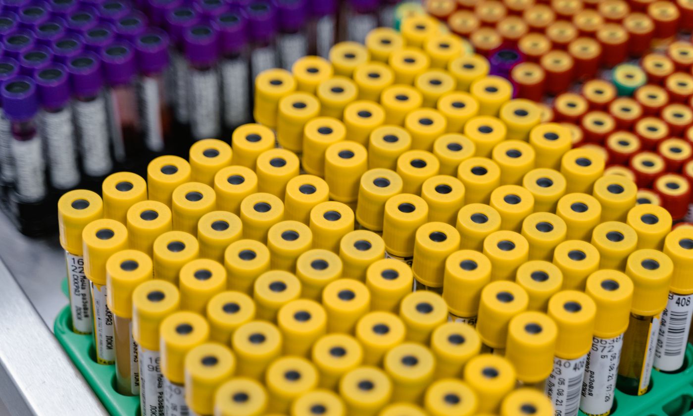 Close-up of multiple laboratory sample tubes with distinct caps