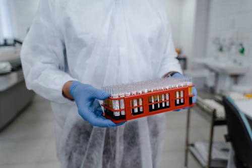 A Person Holding Orange Rack with Blood Samples