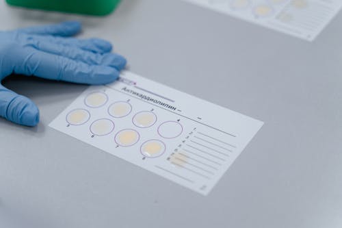 Free stock photo of analysis, bacteria, biochemistry