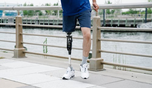 Low Section of Person with Prosthetic Leg 