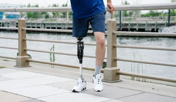 Active adult with a prosthetic leg walking along a waterfront in a casual setting, promoting positivity.
