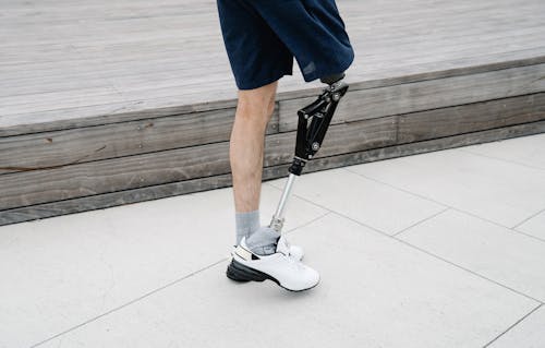 Základová fotografie zdarma na téma amputace, postižení, protetická noha