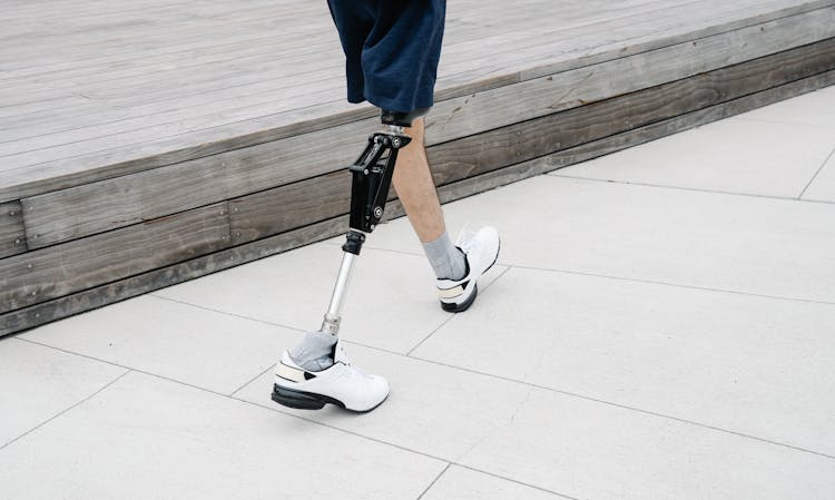 Man Walking With Prosthetic Leg 