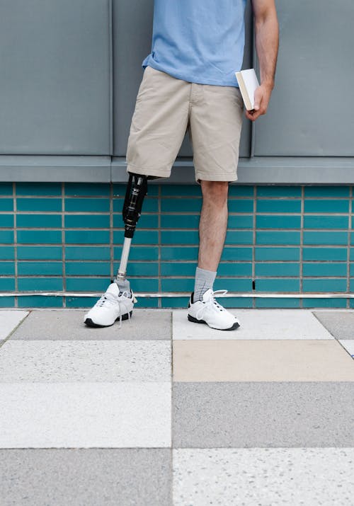 Man with Prosthetic Leg wearing White Sneakers