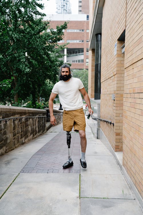 Man with Prosthetic Leg 