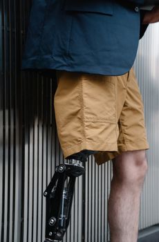 Close-up of a modern prosthetic leg worn by a stylish man in khaki shorts, showcasing body positivity and technology.