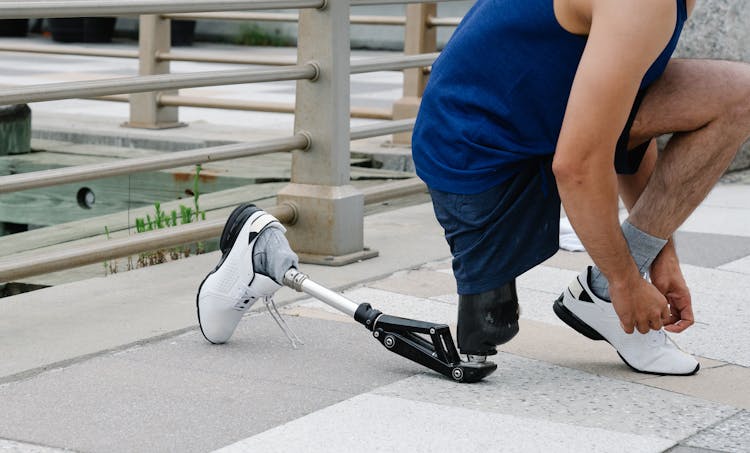 Person With Prosthetic Limb Tying His Shoe Laces