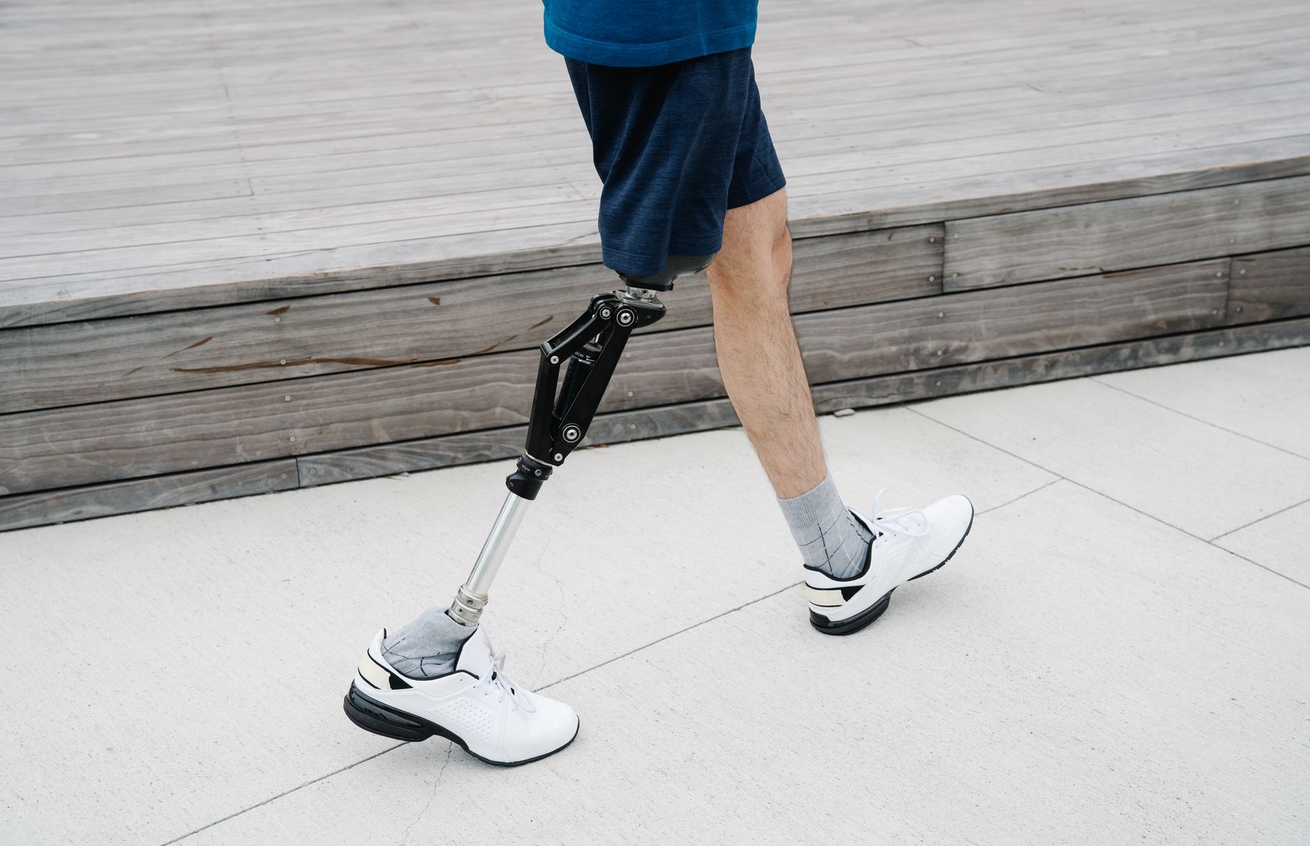 Man walking with Prosthetic Leg