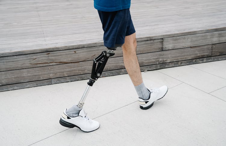 Man Walking With Prosthetic Leg 