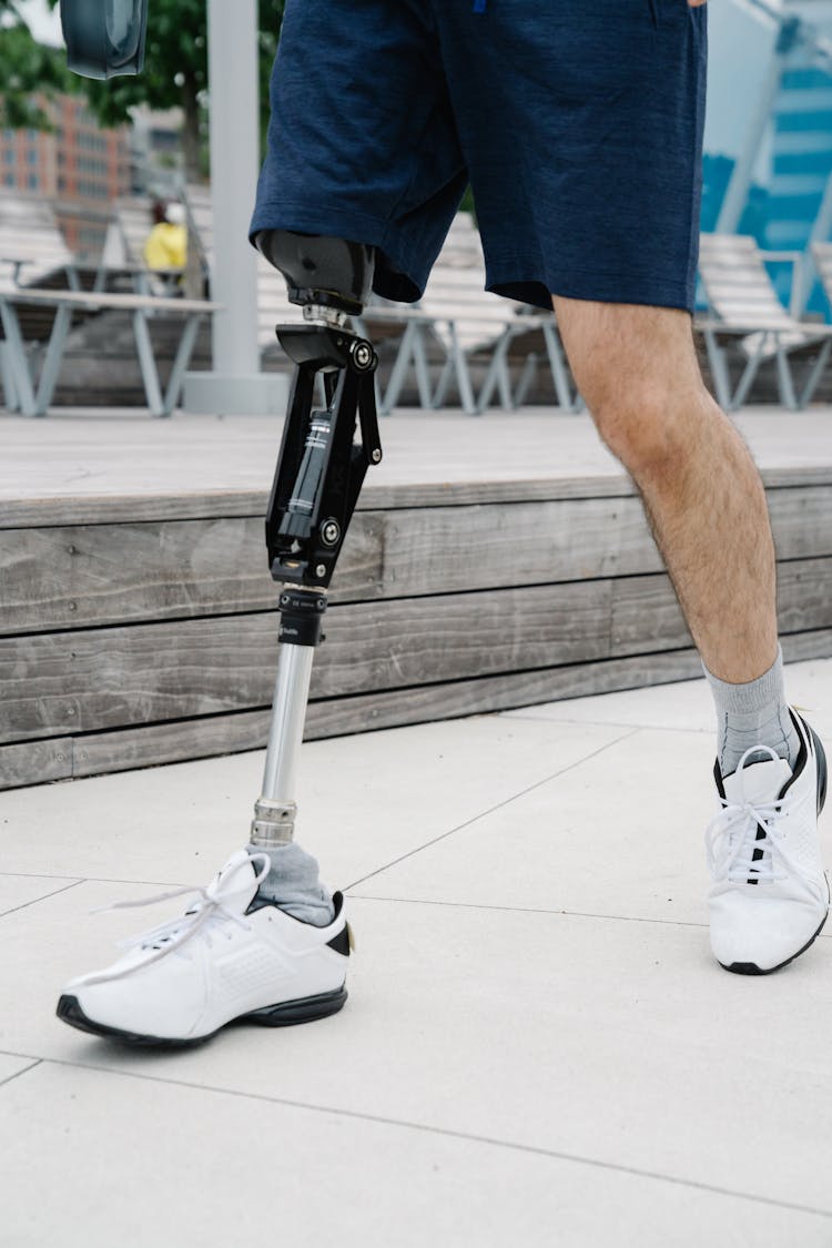 Person With Prosthetic Limb Wearing White Training Shoes