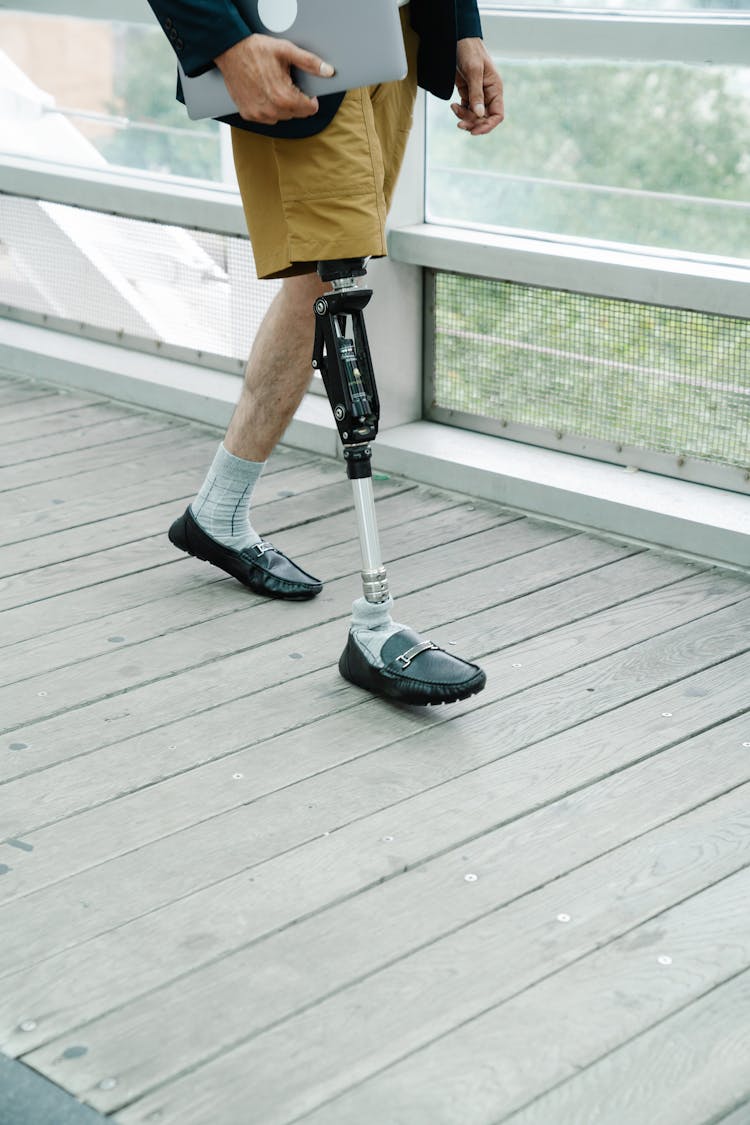 Person With Prosthetic Limb Wearing Black Leather Shoes