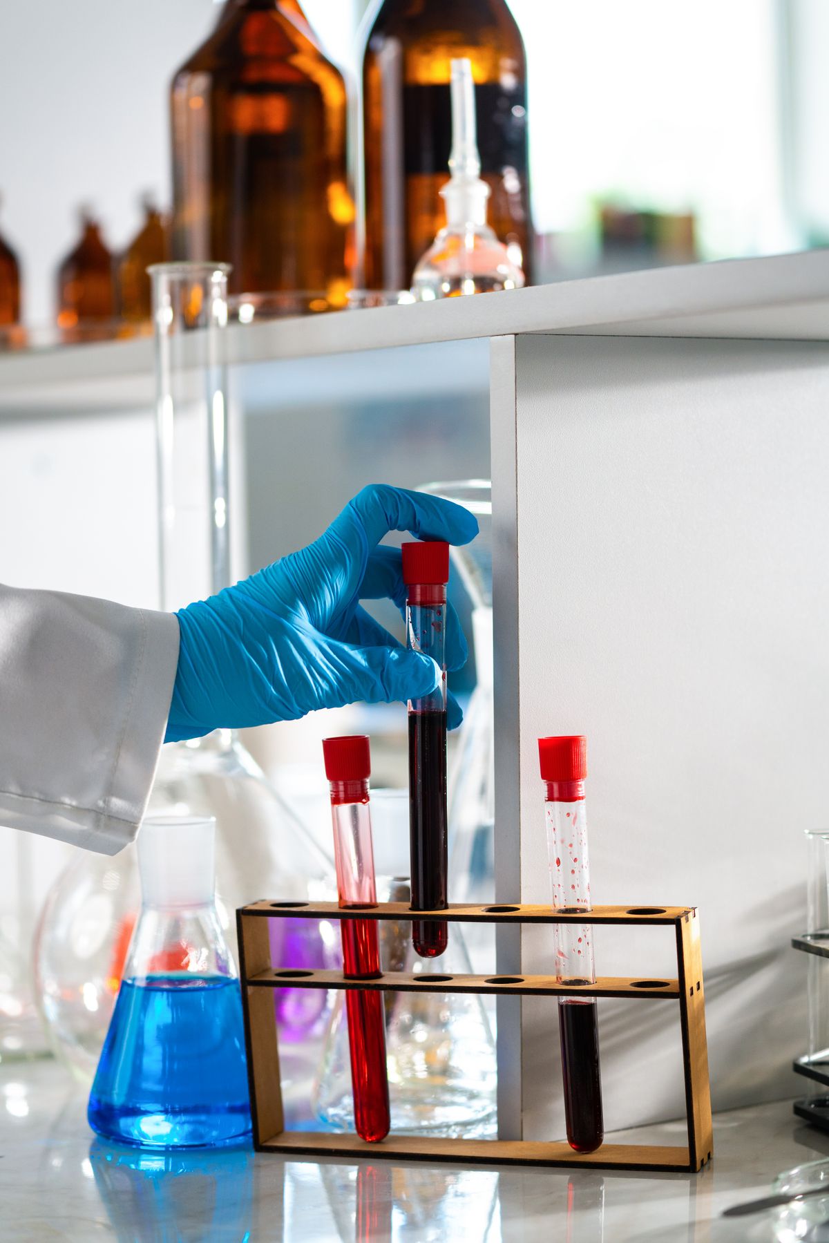 Lab technician working with test tubes in a modern pathology lab