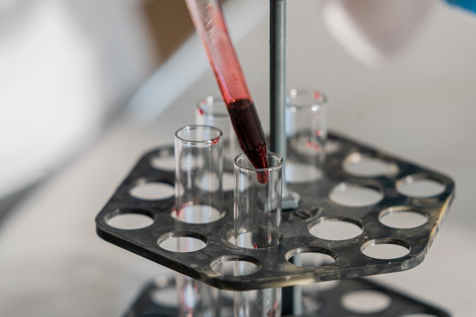 Breathalyzer test measuring BAC in Houston - Drunk driving accident attorney Houston Breathalyzer test measuring BAC in Houston - Drunk driving accident attorney Houston
