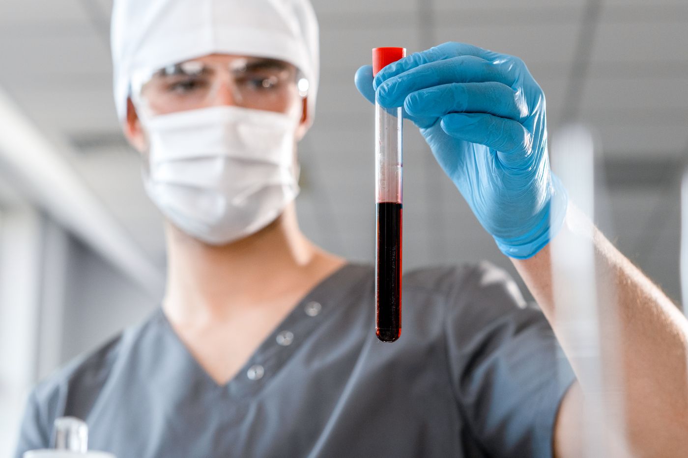 Medical laboratory blood sample