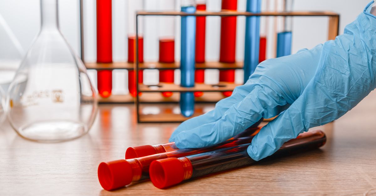 Find Trial Explores ctDNA Surveillance Post-Colorectal Cancer Surgery