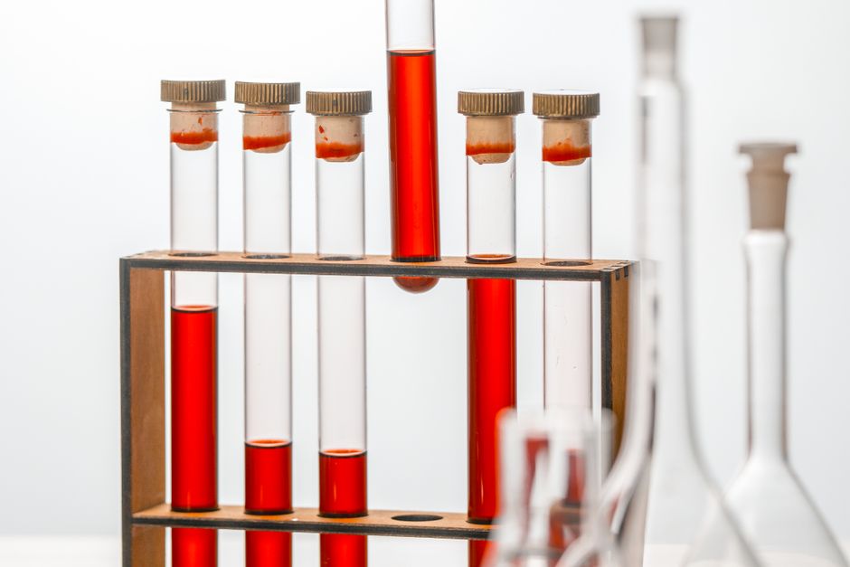 custom peptide dilution ratios laboratory vials custom peptide dilution ratios laboratory vials