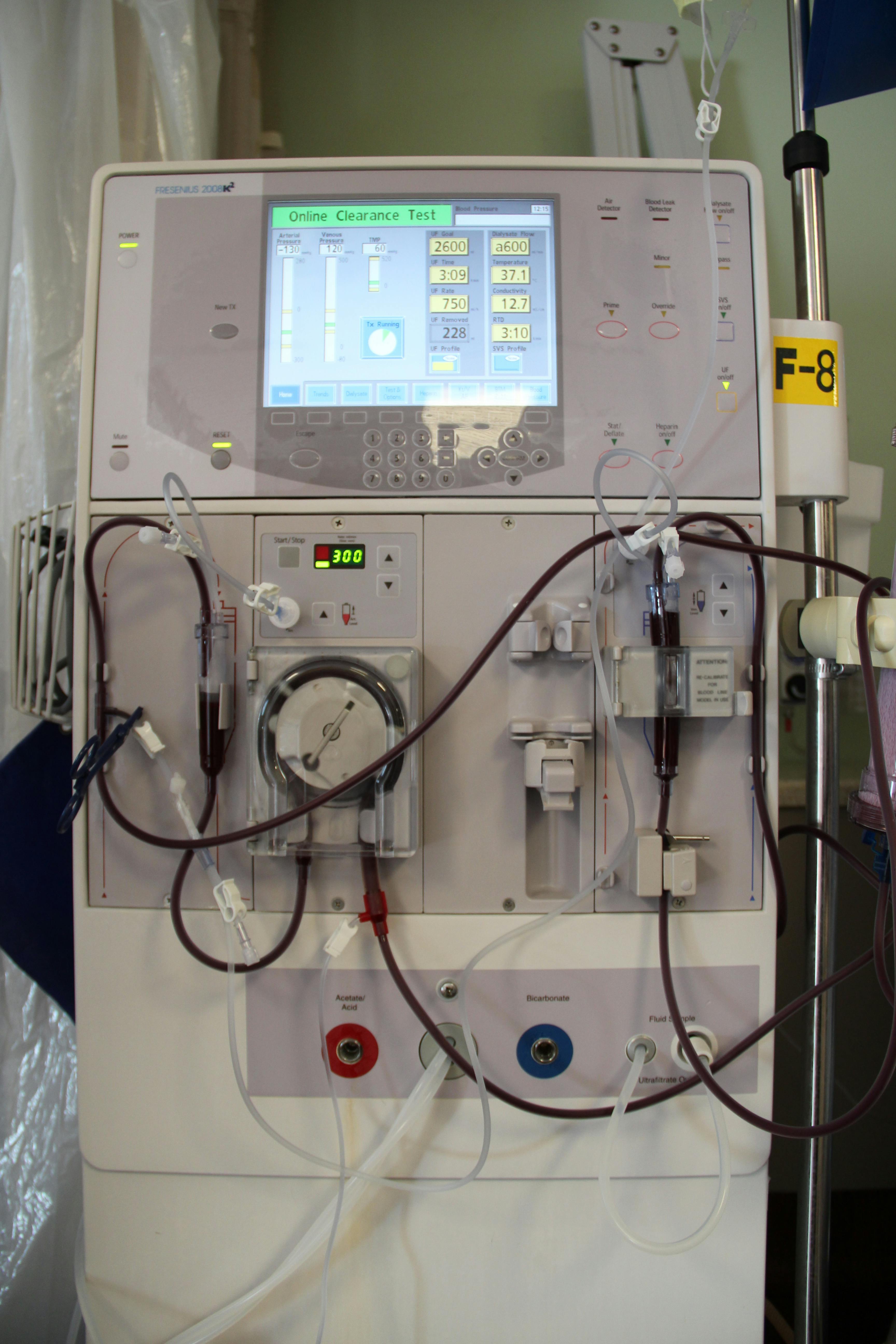 Free stock photo of blood, Dialysis machine, hematology
