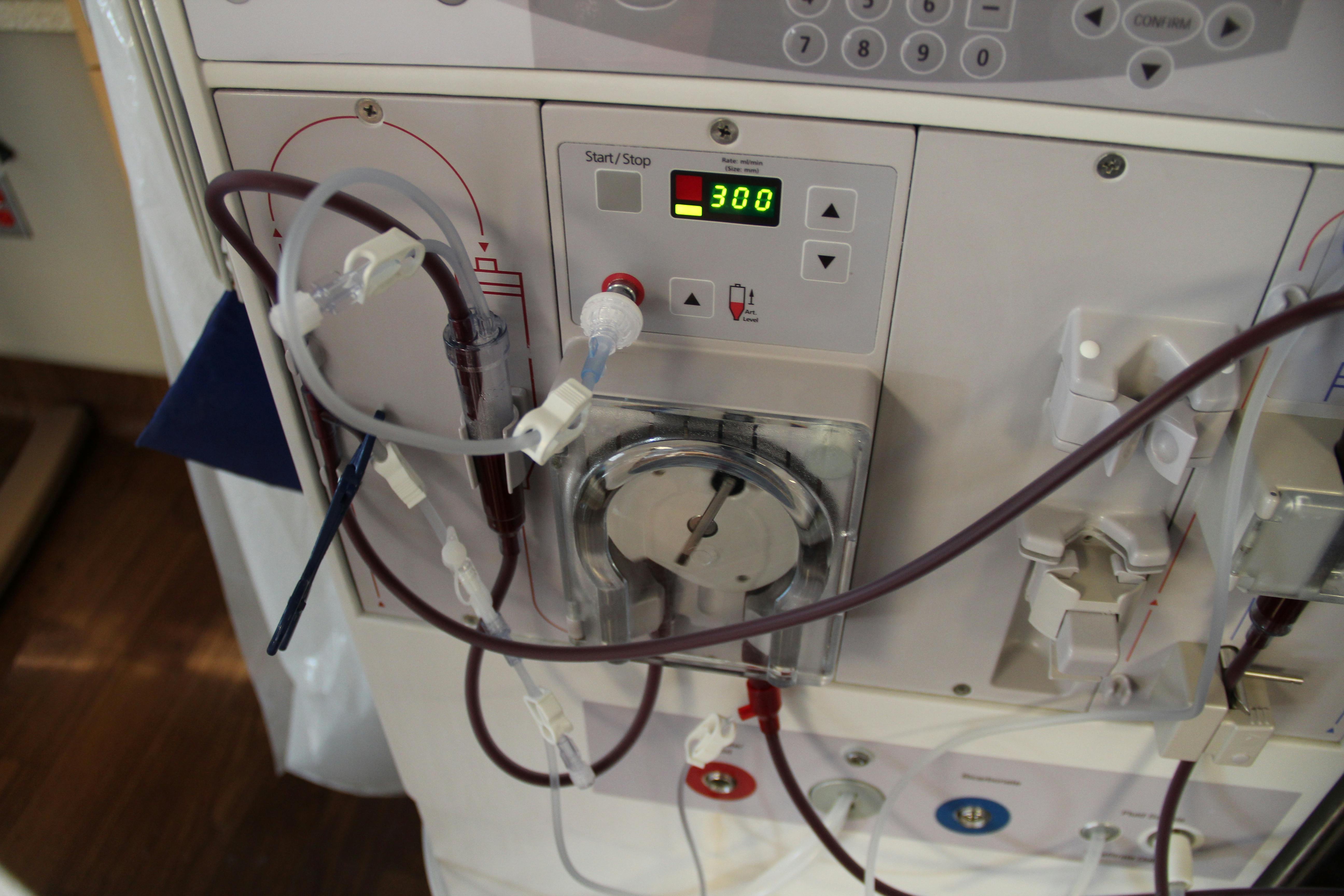 Free stock photo of blood, Dialysis machine, hematology