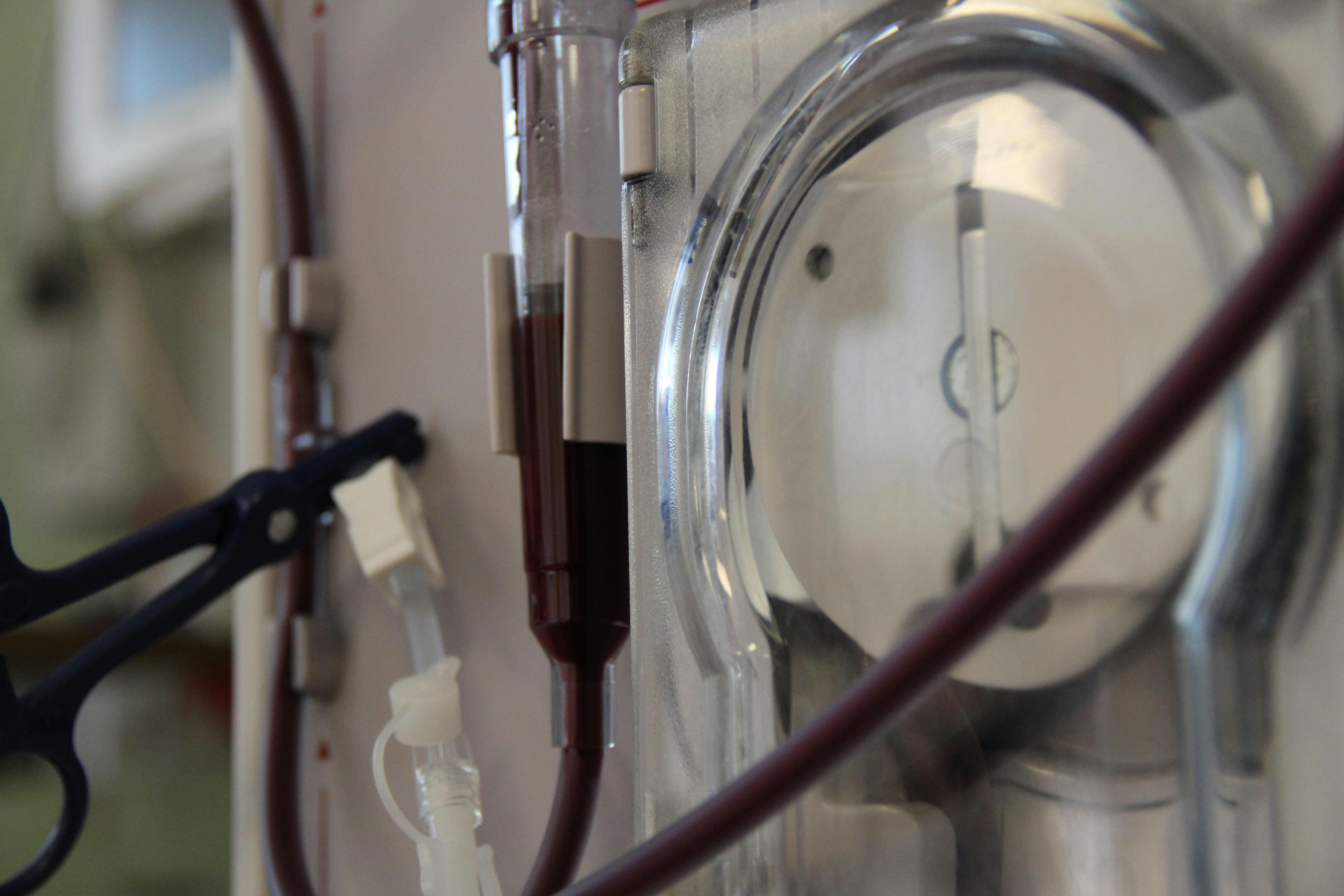 Free stock photo of blood, Dialysis machine, hematology