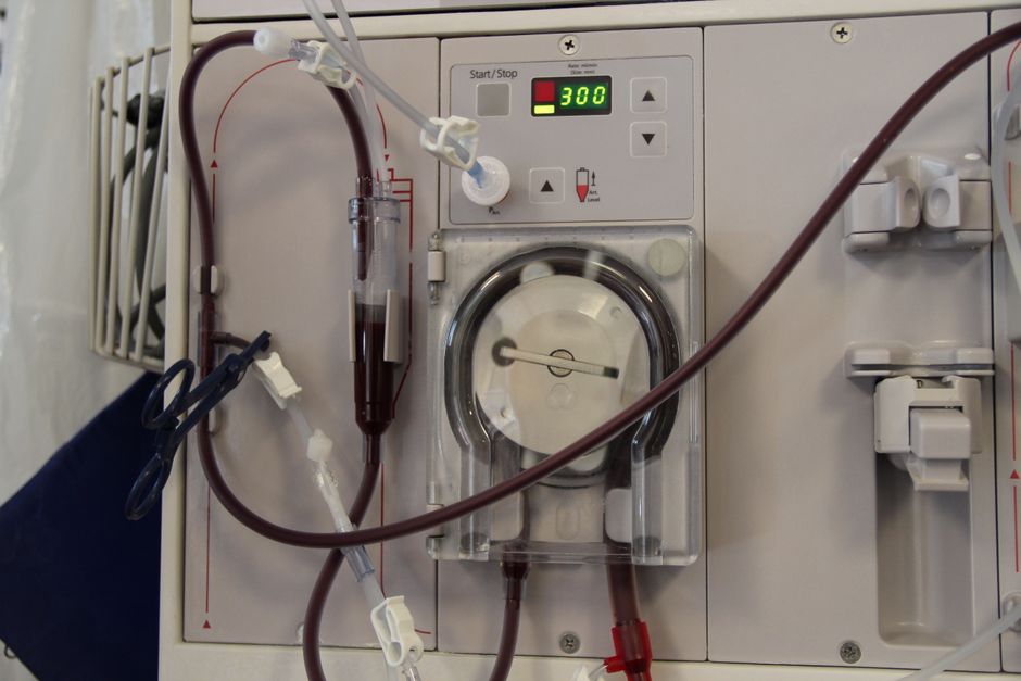 Medical Bleeding Machine Free stock photo of blood, Dialysis machine, hematology