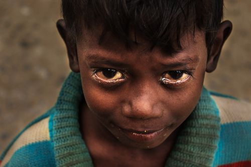 Free A poignant close-up portrait of a sad child in Patna, India, expressing deep emotion. Stock Photo