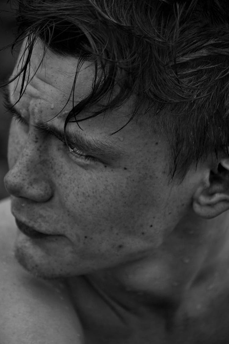 Grayscale Photo Of A Freckled Man