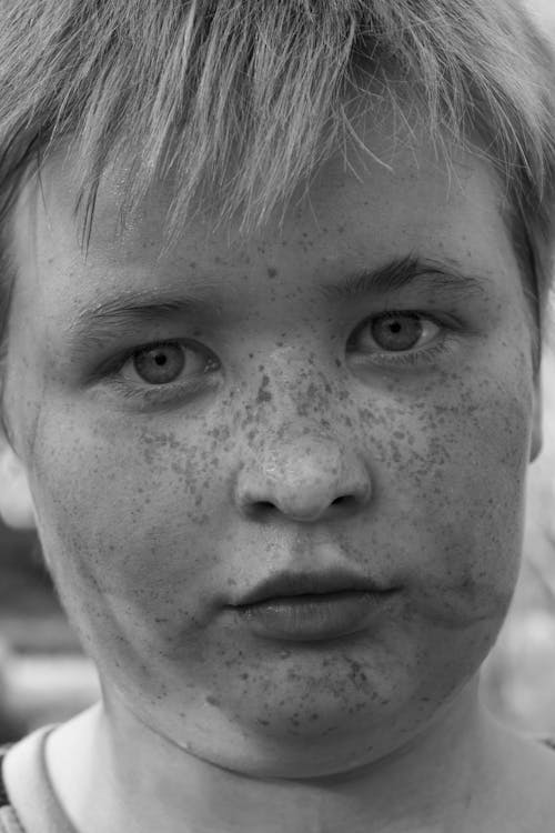 Kostenloses Stock Foto zu einfarbig, freckles, gesicht