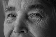 Wrinkles Around the Eyes in Macro Photography