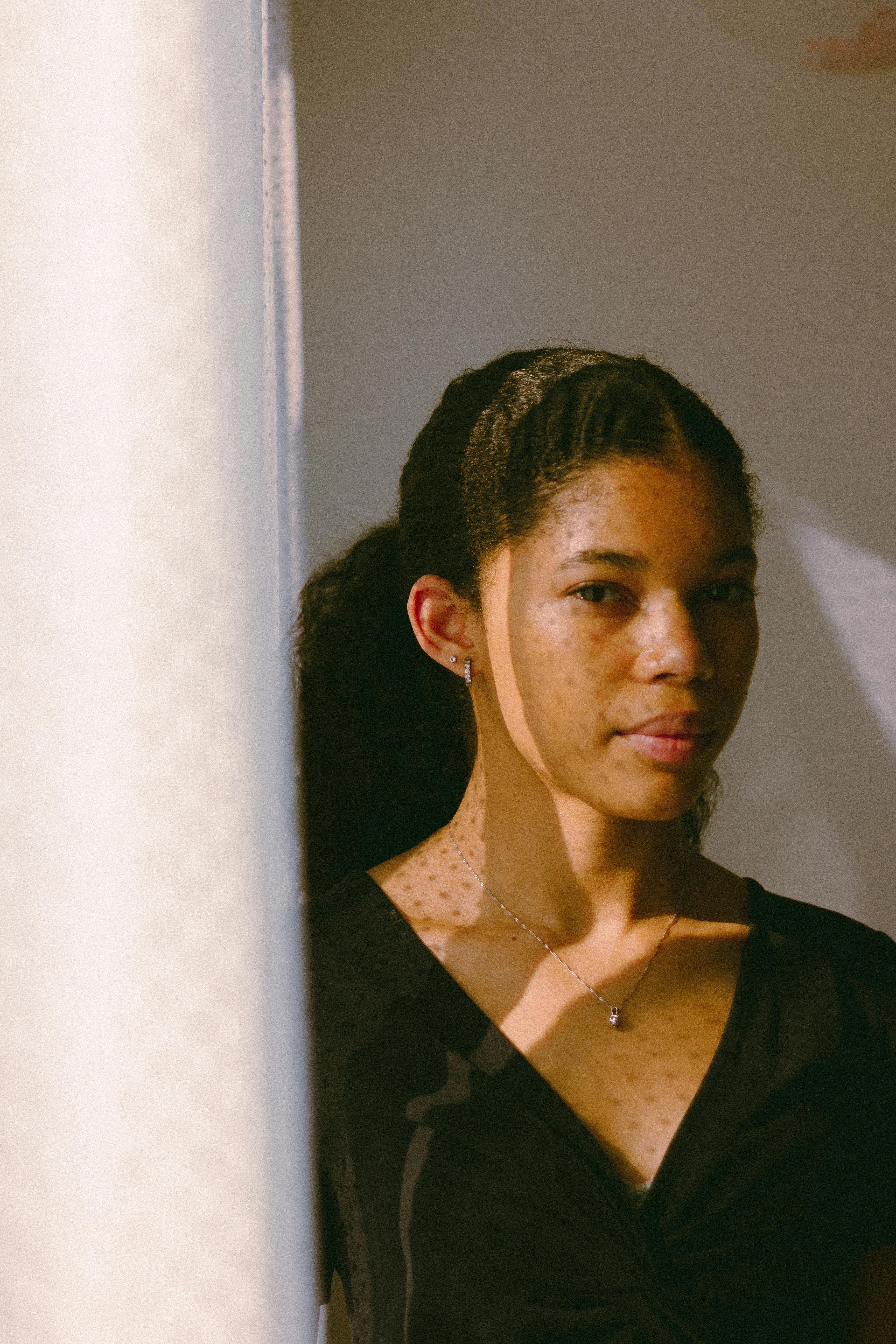 Elegant portrait of a woman with light reflecting on her face, highlighting freckles.