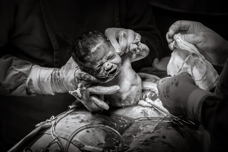 Black And White Photo Of Childbirth