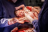 Doctors holding newborn baby