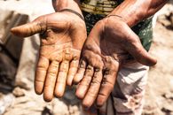 Person Showing Hands with Thick Callus