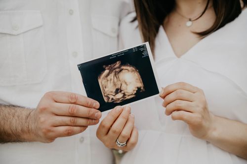 Free Expecting parents holding an ultrasound photo, symbolizing new life and family bonding. Stock Photo