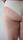 stretch marks