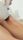 hair removal