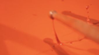 血液脂肪高清视频免费下载免费下载视频素材