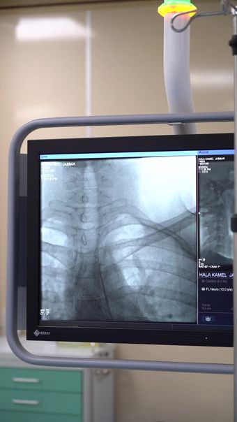 医疗高清视频高清视频免费下载视频素材