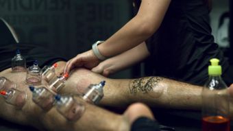拔罐视频素材免费下载高清视频视频素材视频素材