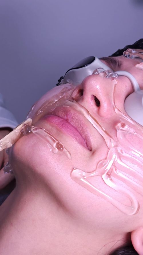 Lumen Aesthetics — Med Spa & Aesthetics in Miami