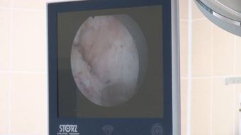 医疗高清视频视频素材高清视频视频素材