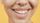 yellow teeth