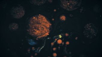 血液脂肪视频素材免费下载高清视频视频素材
